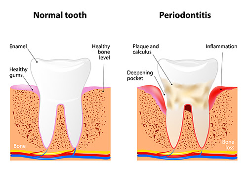 Ph.D. in Basic Dental Sciences: Introduction, Admission, Registration, Eligibility, Duration, Fees, Syllabus 2024